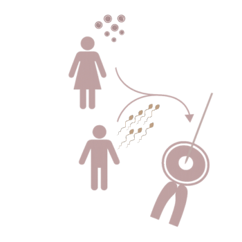 Surrogatefirst gestational surrogacy
